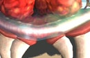 Metroid